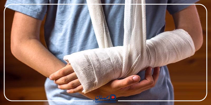 چگونگی محاسبه دیه دست