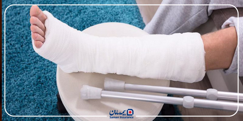 چگونگی محاسبه دیه شکستگی پا در تصادف