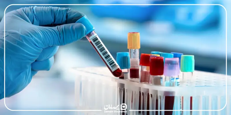 آیا هزینه چکاپ کامل تحت پوشش بیمه است؟