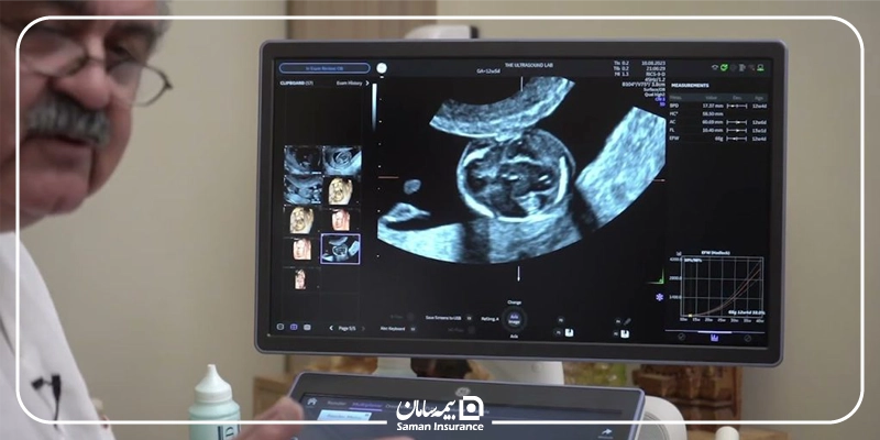 هزینه سونوگرافی با بیمه تأمین اجتماعی