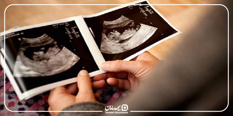 هزینه سونوگرافی بارداری آزاد