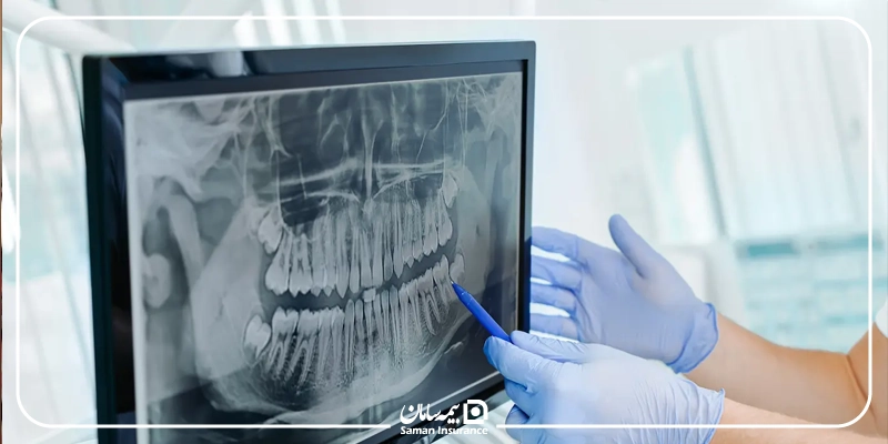 هزینه عکس CBCT با بیمه تامین اجتماعی