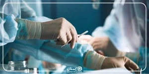 جراحی اسلیو معده با بیمه تکمیلی