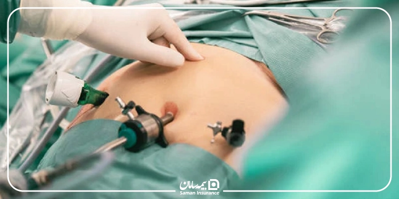 هزینه جراحی اسلیو معده با بیمه تکمیلی در ۱۴۰۵ چقدر است؟
