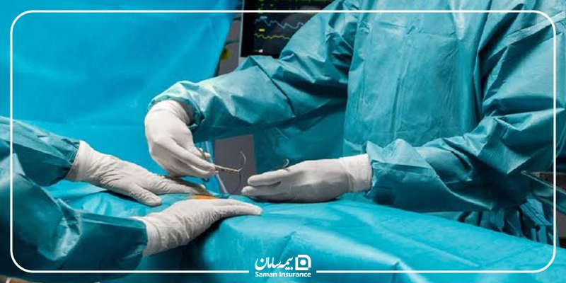 پوشش عمل اسلیو معده با بیمه تکمیلی