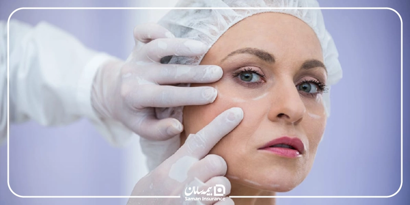 بیمه تکمیلی کدام جراحی زیبایی را پوشش میدهد؟