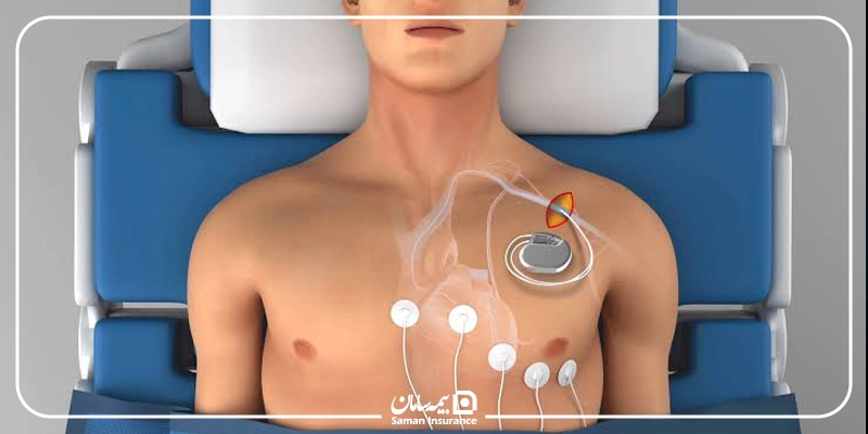 باتری قلب با بیمه تأمین اجتماعی